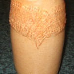 Winuker Burlap